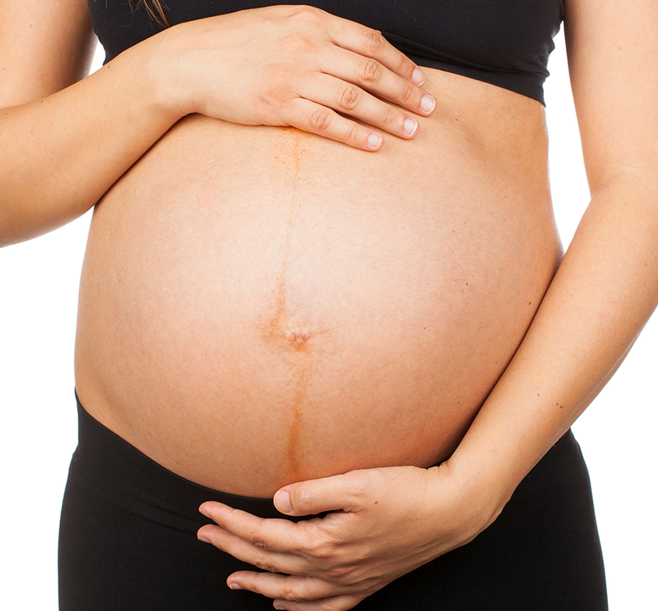 is linea alba normal during pregnancy