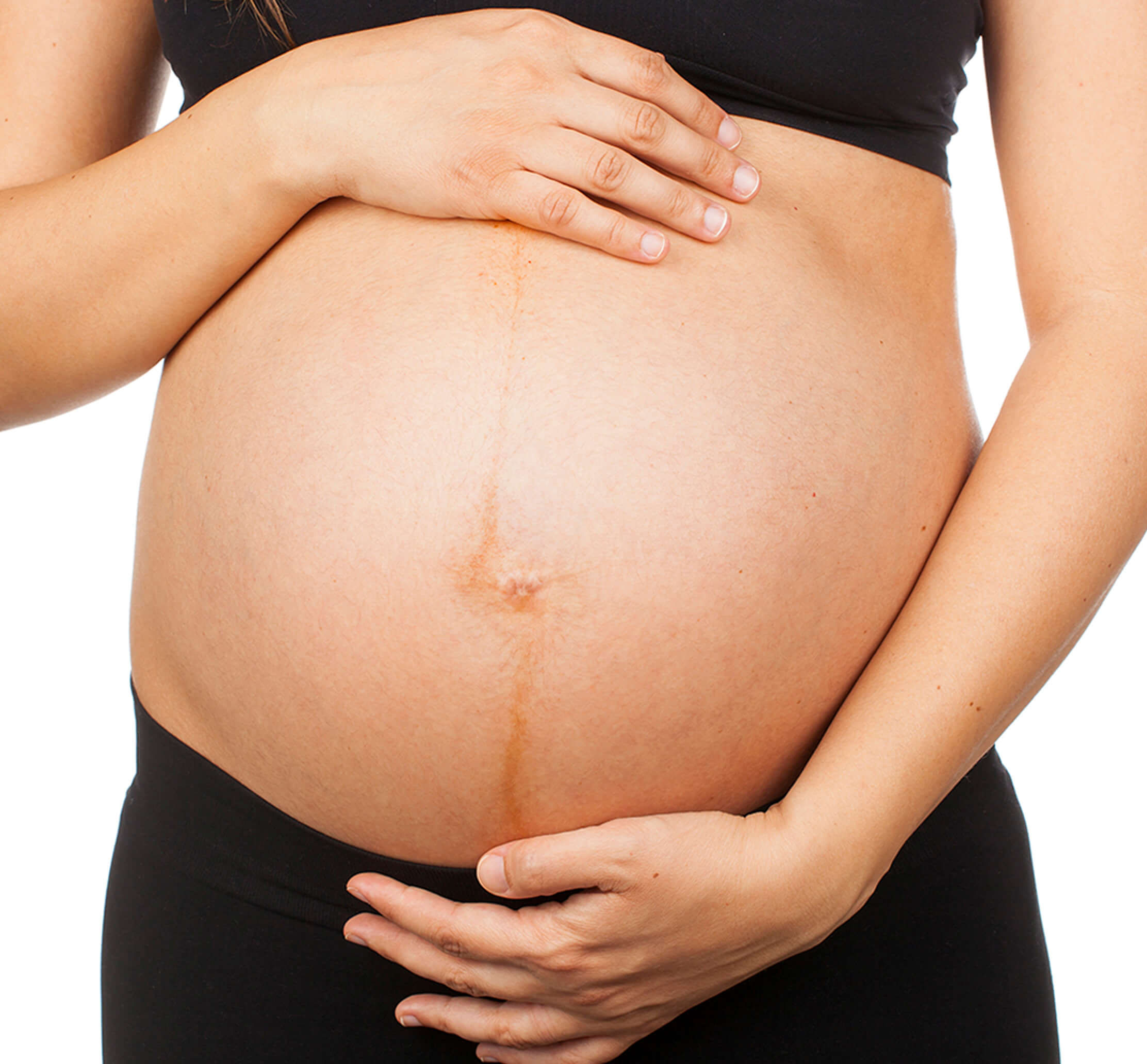 Is a dark line from your navel down your abdomen normal? - Birthing Center  of New York